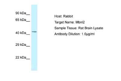 Western Blot: MBNL2 Antibody [NBP2-87783] - Host: Rabbit. Target Name: MBNL2. Sample Tissue: Rat Brain. Antibody Dilution: 1ug/ml