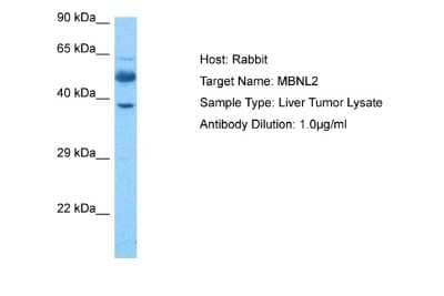 Western Blot: MBNL2 Antibody [NBP2-87784] - Host: Rabbit. Target Name: MBNL2. Sample Tissue: Liver Tumor lysates. Antibody Dilution: 1ug/ml