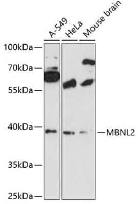 Western Blot: MBNL2 Antibody [NBP3-04746] - Analysis of extracts of various cell lines, using MBNL2 antibody at 1:3000 dilution. Secondary antibody: HRP Goat Anti-Rabbit IgG (H+L) at 1:10000 dilution. Lysates/proteins: 25ug per lane. Blocking buffer: 3% nonfat dry milk in TBST. Detection: ECL Basic Kit