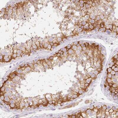 Immunohistochemistry-Paraffin: MBOAT7 Antibody [NBP2-49207] - Staining of human testis shows weak to moderate cytoplasmic and membranous positivity in cells in seminiferous ducts.