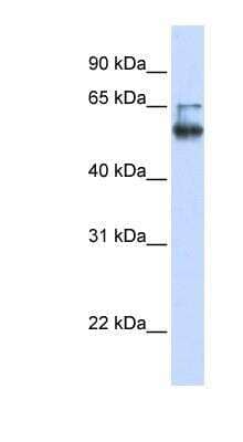 Western Blot: MBOAT7 Antibody [NBP1-62511] - Human Brain lysate, concentration 0.2-1 ug/ml.