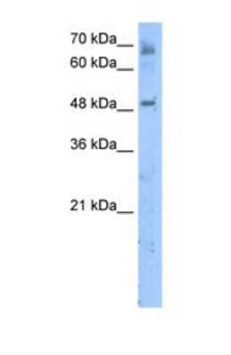 Western Blot: MBOAT7 Antibody [NBP1-69610] - This Anti-LENG4 antibody was used in Western Blot of Jurkat tissue lysate at a concentration of 5ug/ml.