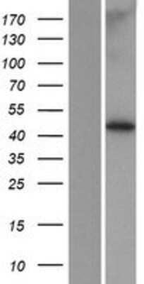 Western Blot: MBOAT7 Overexpression Lysate (Adult Normal) [NBP2-06340] Left-Empty vector transfected control cell lysate (HEK293 cell lysate); Right -Over-expression Lysate for MBOAT7.