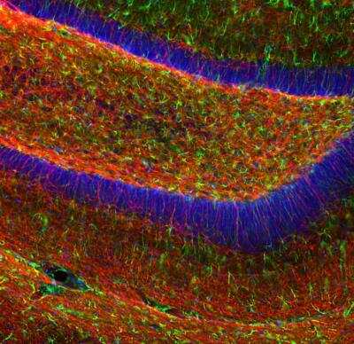 Immunocytochemistry/Immunofluorescence: MBP Antibody [NBP3-05553] - Immunofluorescent analysis of mouse hippocampus section stained with MBP Antibody at a dilution of 1:5,000 in red, and costained with rabbit pAb to GFAP at a dilution of 1:5,000 in green. The blue is Hoechst staining of nuclear DNA. The MBP antibody stains oligodendrocytes and myelin sheathes around axons, while the GFAP antibody reveals the network of glial cells.