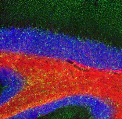 Immunocytochemistry/Immunofluorescence: MBP Antibody [NBP3-05553] - Immunofluorescent analysis of mouse hippocampus section stained with MBP Antibody at a dilution of 1:5,000 in red, and costained with rabbit pAb to GFAP at a dilution of 1:5,000 in green. The blue is Hoechst staining of nuclear DNA. The MBP antibody stains oligodendrocytes and myelin sheathes around axons, while the GFAP antibody reveals the network of glial cells.