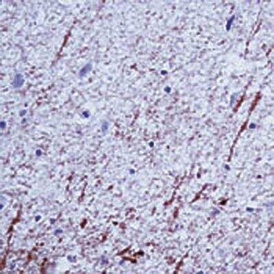Immunohistochemistry-Paraffin: MBP Antibody [NB100-872] - Formalin fixed paraffin embedded human brain stained with MBP antibody.