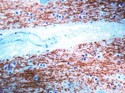 Immunohistochemistry-Paraffin: MBP Antibody [NB100-872] - Formalin fixed paraffin embedded brain .