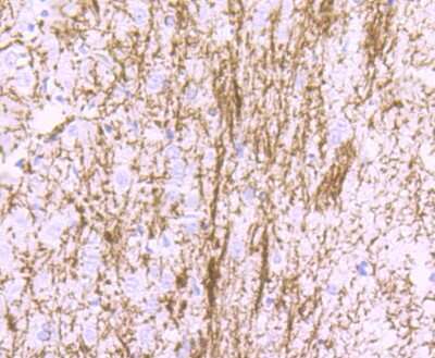 Immunohistochemistry-Paraffin: MBP Antibody (JF0943) [NBP2-66942] - Analysis of paraffin-embedded rat brain tissue using anti-Myelin Basic Protein antibody. Counter stained with hematoxylin.