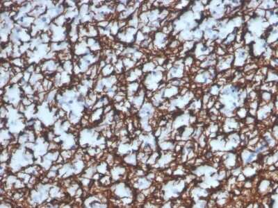 Immunohistochemistry-Paraffin: MBP Antibody (MBP/4277R) [NBP3-08388] - Formalin-fixed, paraffin-embedded human brain stained with MBP Recombinant Rabbit Monoclonal Antibody (MBP/4277R).