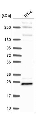 Western Blot: MBP Antibody [NBP2-56185] - Western blot analysis in human cell line RT-4.