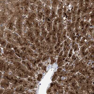 Immunohistochemistry-Paraffin: MBTD1 Antibody [NBP1-93989] - Staining of human liver shows strong cytoplasmic positivity in hepatocytes.
