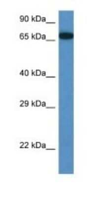Western Blot: MBTD1 Antibody [NBP1-91375] - Titration: 1.0 ug/ml Positive Control: Mouse Pancreas.