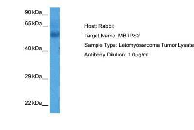 Western Blot: MBTPS2 Antibody [NBP2-85261] - Host: Rabbit. Target Name: MBTPS2. Sample Tissue: Human Leiomyosarcoma Tumor lysates. Antibody Dilution: 1ug/ml