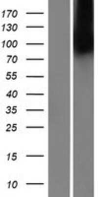 Western Blot: MBTPS2 Overexpression Lysate (Adult Normal) [NBP2-07118] Left-Empty vector transfected control cell lysate (HEK293 cell lysate); Right -Over-expression Lysate for MBTPS2.
