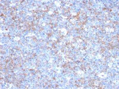 Immunohistochemistry-Paraffin: MCAM/CD146 Antibody (C146/634) - IHC-Prediluted [NBP2-48199] - Formalin-fixed, paraffin-embedded human Tonsil stained with CD146 Monoclonal Antibody (C146/634)