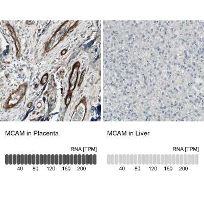 Immunohistochemistry-Paraffin: MCAM/CD146 Antibody [NBP1-88132] - Analysis in human placenta and liver tissues using NBP1-88132 antibody. Corresponding MCAM/CD146 RNA-seq data are presented for the same tissues.