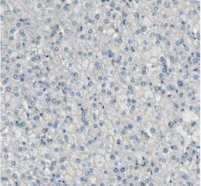 Immunohistochemistry-Paraffin: MCAM/CD146 Antibody [NBP1-88132] - Staining of human liver shows no positivity in hepatocytes as expected.