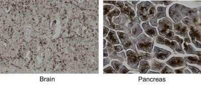 Immunohistochemistry-Paraffin: MCAM/CD146 Antibody (MUC18/1130) - Azide and BSA Free [NBP2-47777] - CD146 was stained in both human brain and pancreatic tissues. CD146 expression was high in pancreatic tissue, yet low in brain tissue as shown by the brown coloration. Image from a verified customer review.