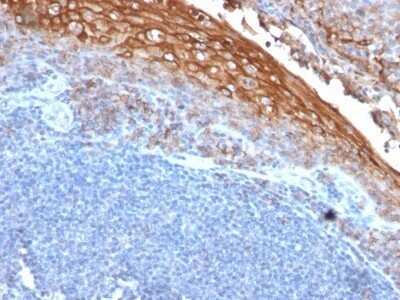 Immunohistochemistry-Paraffin: MCAM/CD146 Antibody (MUC18/1130) - Azide and BSA Free [NBP2-47777] - Human Tonsil stained with MUC18 Monoclonal Antibody (MUC18/1130)