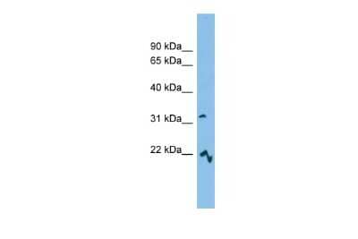 Western Blot: MCART6 Antibody [NBP2-83186] - WB Suggested Anti-MCART6 Antibody Titration: 0.2-1 ug/ml. ELISA Titer: 1:312500. Positive Control: Hela cell lysate