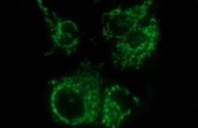 Immunocytochemistry/Immunofluorescence: MCAT Antibody (OTI2B7) - Azide and BSA Free [NBP2-72596] - Analysis of COS7 cells transiently transfected by pCMV6-ENTRY MCAT.