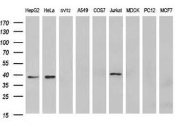 Western Blot: MCAT Antibody (OTI2B7) - Azide and BSA Free [NBP2-72596] - Analysis of extracts (35ug) from 9 different cell lines by using MCAT monoclonal antibody at 1:400 dilution (HepG2: human; HeLa: human; SVT2: mouse; A549: human; COS7: monkey; Jurkat: human; MDCK: canine; PC12: rat; MCF7: human).