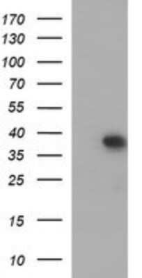 Western Blot: MCAT Antibody (OTI2B7) - Azide and BSA Free [NBP2-72596] - Analysis of HEK293T cells were transfected with the pCMV6-ENTRY control (Left lane) or pCMV6-ENTRY MCAT.