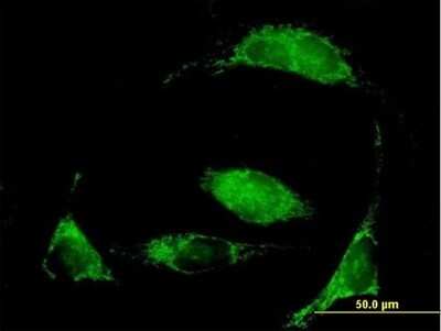 Immunocytochemistry/Immunofluorescence: MCCC2 Antibody [H00064087-B01P] - Analysis of purified antibody to MCCC2 on HeLa cell. (antibody concentration 10 ug/ml)