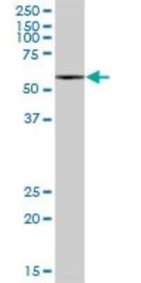 Western Blot: MCCC2 Antibody [H00064087-B01P] - Analysis of MCCC2 expression in human liver.