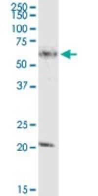 Western Blot: MCCC2 Antibody [H00064087-D01P] - Analysis of MCCC2 expression in human colon.