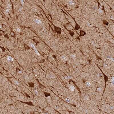 Immunohistochemistry: MCCD1 Antibody [NBP2-47382] - Staining of human cerebral cortex shows strong cytoplasmic positivity in neuronal cells.