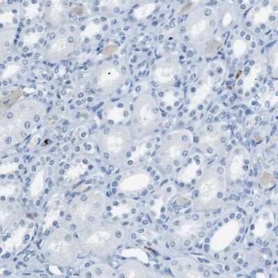 Immunohistochemistry-Paraffin MCEMP1 Antibody - BSA Free