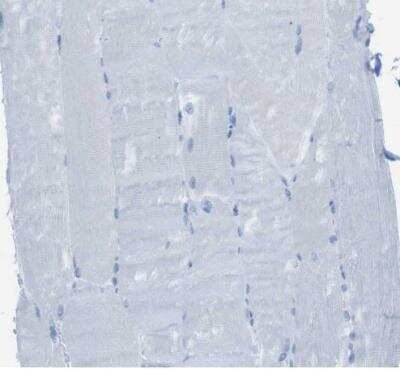 Immunohistochemistry-Paraffin MCEMP1 Antibody - BSA Free