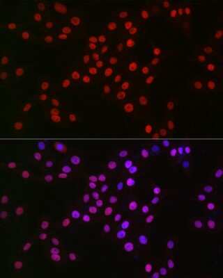 Immunocytochemistry/Immunofluorescence: MCM2 Antibody (0Q10S9) [NBP3-16066] - Immunofluorescence analysis of PC-12 cells using MCM2 Rabbit mAb (NBP3-16066) at dilution of 1:100 (40x lens). Blue: DAPI for nuclear staining.