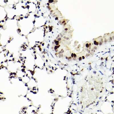 Immunohistochemistry-Paraffin: MCM2 Antibody (0Q10S9) [NBP3-16066] - Immunohistochemistry of paraffin-embedded mouse lung using MCM2 Rabbit mAb (NBP3-16066) at dilution of 1:100 (40x lens).Perform high pressure antigen retrieval with 10 mM citrate buffer pH 6.0 before commencing with IHC staining protocol.