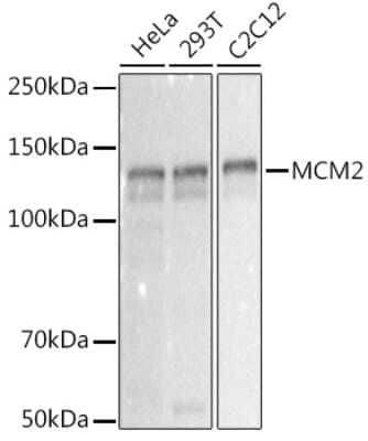 Western Blot: MCM2 Antibody (0Q10S9) [NBP3-16066] - Western blot analysis of extracts of various cell lines, using MCM2 antibody (NBP3-16066) at 1:1000 dilution. Secondary antibody: HRP Goat Anti-Rabbit IgG (H+L) at 1:10000 dilution. Lysates/proteins: 25ug per lane. Blocking buffer: 3% nonfat dry milk in TBST. Detection: ECL Basic Kit. Exposure time: 0.3s.