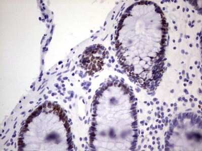 Immunohistochemistry: MCM2 Antibody (3C12) [NBP2-45774] - Analysis of Human colon tissue. (Heat-induced epitope retrieval by 1 mM EDTA in 10mM Tris, pH8.5, 120C for 3min)