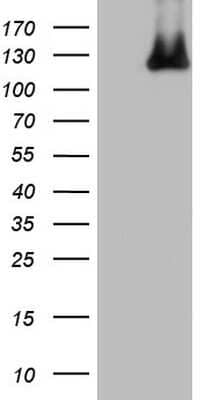 Western Blot: MCM2 Antibody (3C12) [NBP2-45774] - Analysis of HEK293T cells were transfected with the pCMV6-ENTRY control (Left lane) or pCMV6-ENTRY MCM2 .