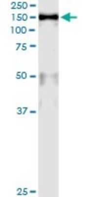 Immunoprecipitation: MCM2 Antibody (6A8) [H00004171-M01] - Analysis of MCM2 transfected lysate using anti-MCM2 monoclonal antibody and Protein A Magnetic Bead, and immunoblotted with MCM2 MaxPab rabbit polyclonal antibody.