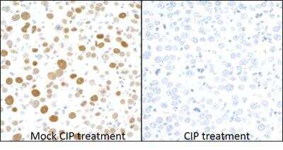 Immunohistochemistry: MCM2 Antibody (BLR108H) [NBP3-07021] - Detection of mouse Phospho-MCM2 (S53) in FFPE mouse renal cell carcinoma by IHC. Antibody: Rabbit anti-MCM2 (S53) recombinant monoclonal [BLR108H]. Secondary: HRP-conjugated goat anti-rabbit IgG  Substrate: DAB.