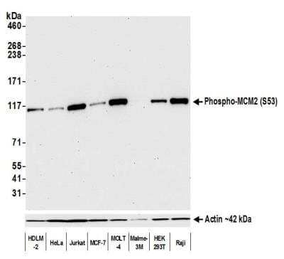 Western Blot: MCM2 Antibody (BLR108H) [NBP3-07021] - Detection of human Phospho-MCM2 by WB of HDLM-2, HeLa, Jurkat, MCF-7, MOLT-4, Malme-3M, HEK293T, and Raji lysate. Antibody: Rabbit anti-Phospho-MCM2 recombinant monoclonal [BLR108H]. Secondary: HRP-conjugated goat anti-rabbit IgG. Lower Panel: Rabbit anti-Actin recombinant monoclonal.