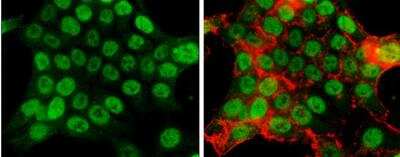 Immunocytochemistry/Immunofluorescence: MCM2 Antibody [NBP2-17238] - HCT116 cells were fixed in 4% paraformaldehyde at RT for 15 min. Green: MCM2 protein stained by MCM2 antibody [N1N2], N-term diluted at 1:500. Red: phalloidin, a cytoskeleton marker, diluted at 1:50.