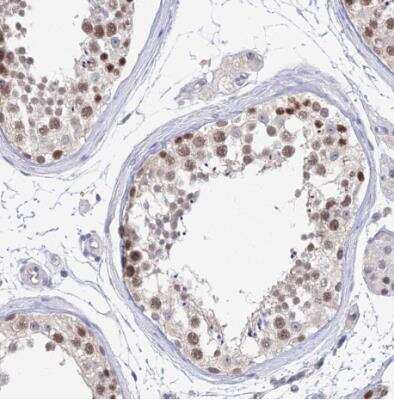 Immunohistochemistry-Paraffin: MCM2 Antibody [NBP2-33953] - Staining of human testis shows moderate nuclear positivity in cells in seminiferous ducts.