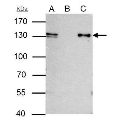 Immunoprecipitation: MCM2 Antibody [NBP2-17238] - IP samples: HCT-116 whole cell extract A. 40 ug HCT-116 whole cell extract B. Control with 4 ug of preimmune Rabbit IgG C. Immunoprecipitation of MCM2 protein by 4 ug MCM2 antibody [N1N2], N-term  7.5 % SDS-PAGE The immunoprecipitated MCM2 protein was detected by MCM2 antibody [N1N2], N-term diluted at 1:500. [EasyBlot anti-rabbit IgG was used as a secondary reagent]