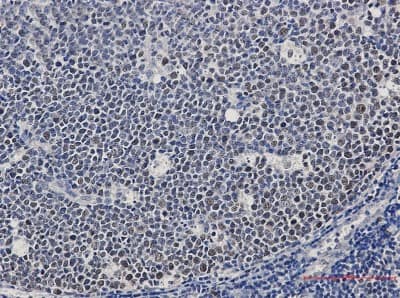 Immunohistochemistry-Paraffin: MCM2 Antibody (S02-0D3) [NBP3-19887] - Immunohistochemistry of MCM2 in paraffin-embedded Human tonsil using NBP3-19887 at dilution 1/50