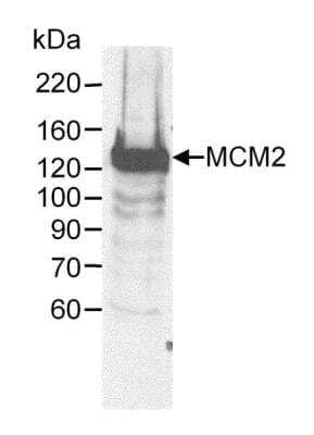 Western Blot: MCM2 Antibody [NB100-244] - Whole cell lysate (60 ug) from HeLa cells. Antibody used at 0.25 ug/ml.