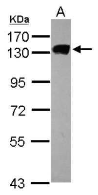 Western Blot: MCM2 Antibody [NBP2-17238] - Sample (30 ug of whole cell lysate) A: HCT116 7. 5% SDS PAGE gel, diluted at 1:1000.