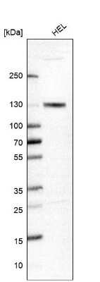 <b>Orthogonal Strategies Validation. </b>Western Blot: MCM2 Antibody [NBP2-33954] - Analysis in human cell line HEL.