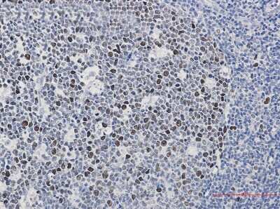 Immunohistochemistry-Paraffin: MCM2 [p Ser40] Antibody (S03-1B3) [NBP3-14952] - Immunohistochemistry of MCM2 [p Ser40] in paraffin-embedded Human tonsil using MCM2 [p Ser40] Rabbit mAb at dilution 1/50