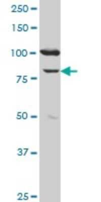 Western Blot: MCM3 Antibody (2H3) [H00004172-M04] - Analysis of MCM3 expression in human ovarian cancer.